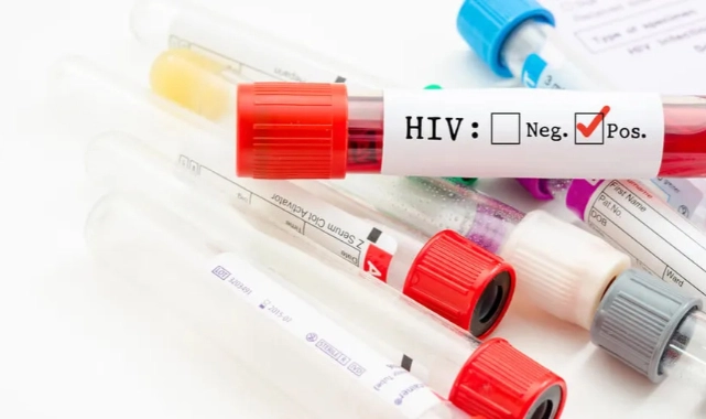 AIDS sebebiyle hayatını kaybetmişti: Babasının ifadesi ortaya çıktı