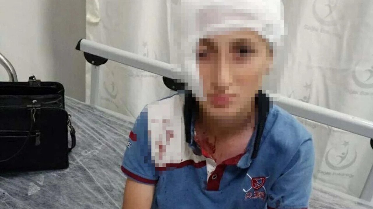 Yüzünde iz kaldı, tazminatı 1,2 milyon TL oldu